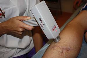 laserterapia
